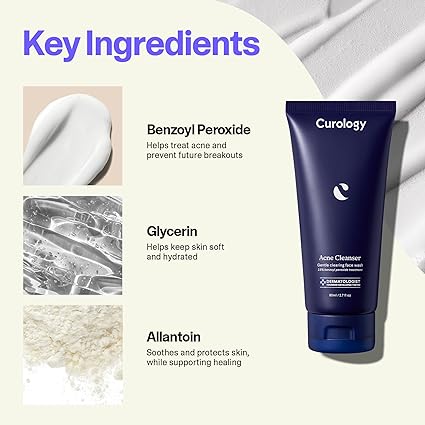 Acne Cleanser, Gentle Clearing Face Wash, Benzoyl Peroxide Treatment for Acne Prone Skin, Milky Gel Texture, Fragrance Free, 5.07 fl oz (Pack of 1)